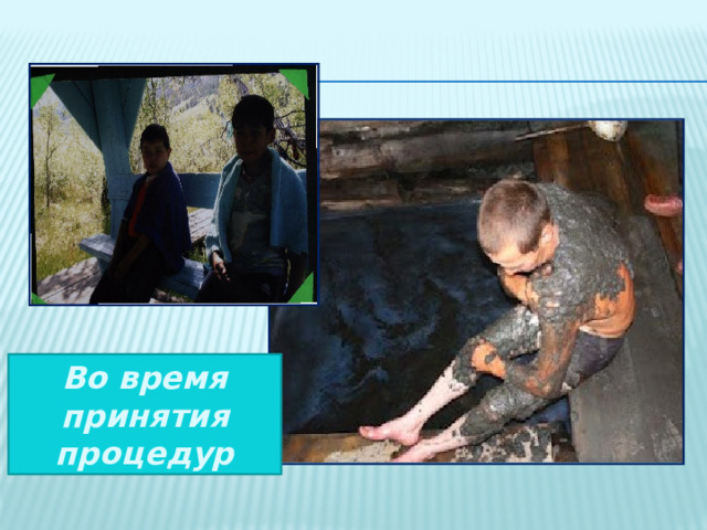 Во время принятия процедур 
