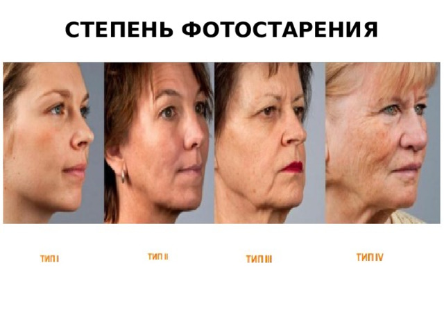 СТЕПЕНЬ ФОТОСТАРЕНИЯ   