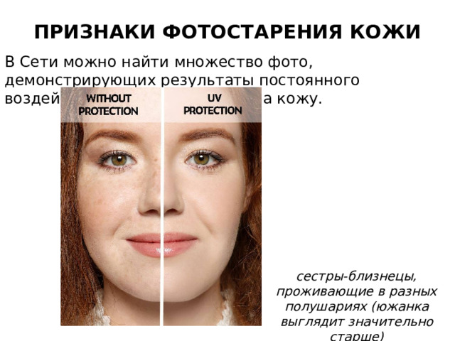 ПРИЗНАКИ ФОТОСТАРЕНИЯ КОЖИ   В Сети можно найти множество фото, демонстрирующих результаты постоянного воздействия солнечных лучей на кожу.  сестры-близнецы, проживающие в разных полушариях (южанка выглядит значительно старше) 