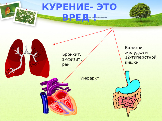 Курение- это вред !    Болезни, связанные с курением Болезни желудка и 12-типерстной кишки Бронхит, эмфизит, рак Инфаркт 