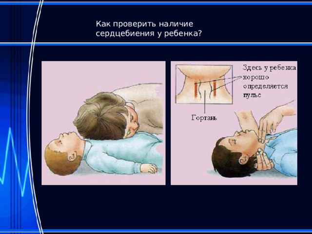Как проверить наличие сердцебиения у ребенка? 