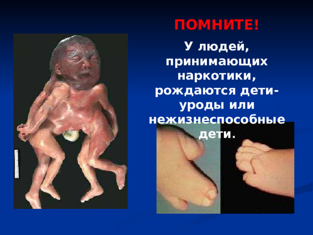 ПОМНИТЕ! У людей, принимающих наркотики, рождаются дети-уроды или нежизнеспособные дети . 