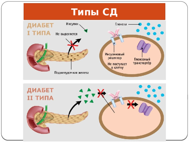 Типы СД 