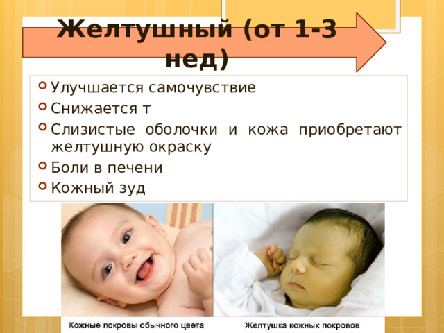 Желтушный (от 1-3 нед) Улучшается самочувствие Снижается т Слизистые оболочки и кожа приобретают желтушную окраску Боли в печени Кожный зуд 