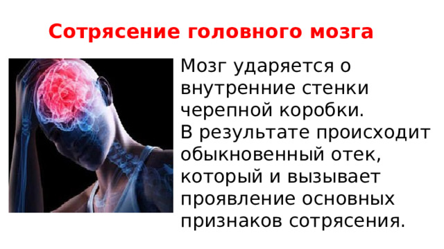 Сотрясение головного мозга Мозг ударяется о внутренние стенки черепной коробки. В результате происходит обыкновенный отек, который и вызывает проявление основных признаков сотрясения. 