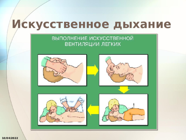 Искусственное дыхание 10/04/2022 