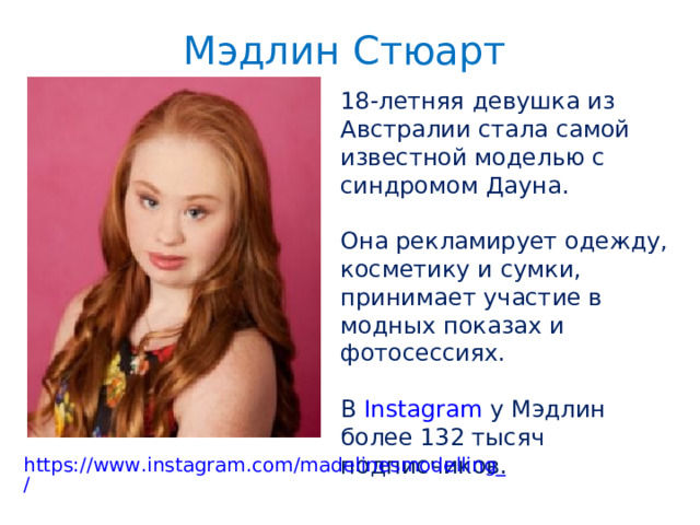 Мэдлин Стюарт 18-летняя девушка из Австралии стала самой известной моделью с синдромом Дауна. Она рекламирует одежду, косметику и сумки, принимает участие в модных показах и фотосессиях. В  Instagram  у Мэдлин более 132 тысяч подписчиков. https://www.instagram.com/madelinesmodelling_/ 