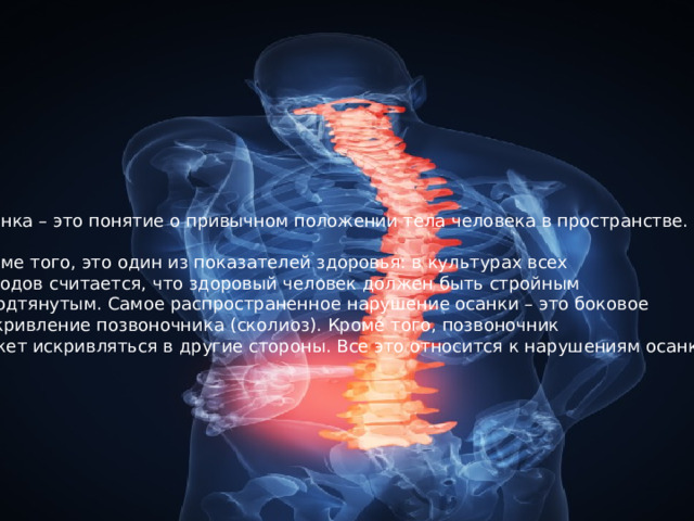 Осанка – это понятие о привычном положении тела человека в пространстве. Кроме того, это один из показателей здоровья: в культурах всех народов считается, что здоровый человек должен быть стройным и подтянутым. Самое распространенное нарушение осанки – это боковое  искривление позвоночника (сколиоз). Кроме того, позвоночник может искривляться в другие стороны. Все это относится к нарушениям осанки . 