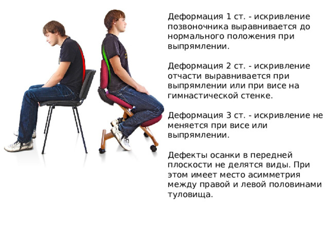 Деформация 1 ст. - искривление позвоночника выравнивается до нормального положения при выпрямлении. Деформация 2 ст. - искривление отчасти выравнивается при выпрямлении или при висе на гимнастической стенке. Деформация 3 ст. - искривление не меняется при висе или выпрямлении. Дефекты осанки в передней плоскости не делятся виды. При этом имеет место асимметрия между правой и левой половинами туловища. 