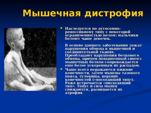Мышечная дистрофия Наследуется по аутосомно-рецессивному типу с некоторой ограниченностью полом: мальчики болеют чаще девочек.   В основе данного заболевания лежат нарушения обмена в мышечной и соединительной тканях. Преобладают нарушения белкового обмена, причем повышенный синтез мышечных белков сопровождается еще более ускоренным их распадом. Чаще всего поражаются нижние конечности, затем мышцы тазового пояса, туловища, верхних конечностей («восходящий тип»). Реже встречается «нисходящий тип». Тонус и сила мышц снижаются, развивается их атрофия .   