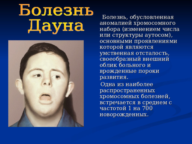 Болезнь, обусловленная аномалией хромосомного набора (изменением числа или структуры аутосом), основными проявлениями которой являются умственная отсталость, своеобразный внешний облик больного и врожденные пороки развития.  Одна из наиболее распространенных хромосомных болезней, встречается в среднем с частотой 1 на 700 новорожденных.  