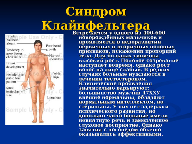 Синдром Клайнфельтера Встречается у одного из 400-600 новорождённых мальчиков и проявляется в недоразвитии первичных и вторичных половых признаков, искажении пропорций тела. Для больных типичны высокий рост. Половое созревание наступает вовремя, однако рост волос на лице слабый. В редких случаях больные нуждаются в лечении тестостероном. Клинические проявления значительно варьируют: большинство мужчин 47ХХУ внешне нормальны, обладают нормальным интеллектом, но стерильны. У них нет задержки психического развития, но довольно часто больные имели невнятную речь и замедленное слуховое восприятие. Однако занятия с логопедом обычно оказывались эффективными. 