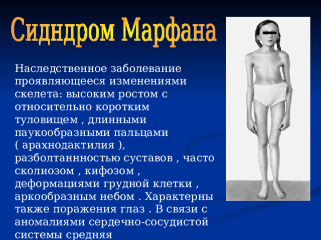 Наследственное заболевание проявляющееся изменениями скелета: высоким ростом с относительно коротким туловищем , длинными паукообразными пальцами ( арахнодактилия ), разболтаннностью суставов , часто сколиозом , кифозом , деформациями грудной клетки , аркообразным небом . Характерны также поражения глаз . В связи с аномалиями сердечно-сосудистой системы средняя продолжительность жизни сокращена. 