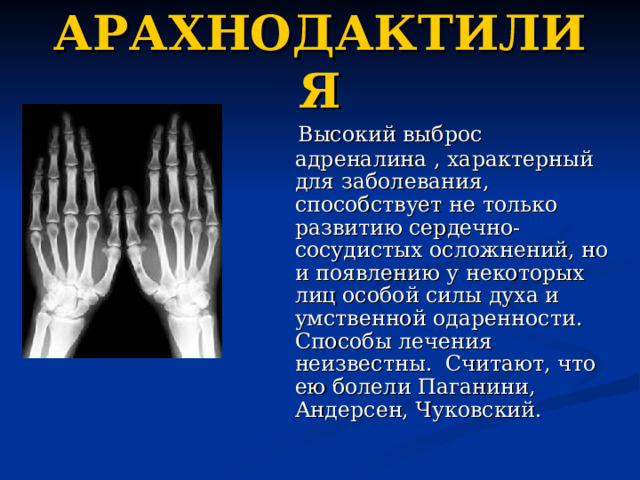 АРАХНОДАКТИЛИЯ  Высокий выброс адреналина , характерный для заболевания, способствует не только развитию сердечно-сосудистых осложнений, но и появлению у некоторых лиц особой силы духа и умственной одаренности. Способы лечения неизвестны. Считают, что ею болели Паганини, Андерсен, Чуковский.  