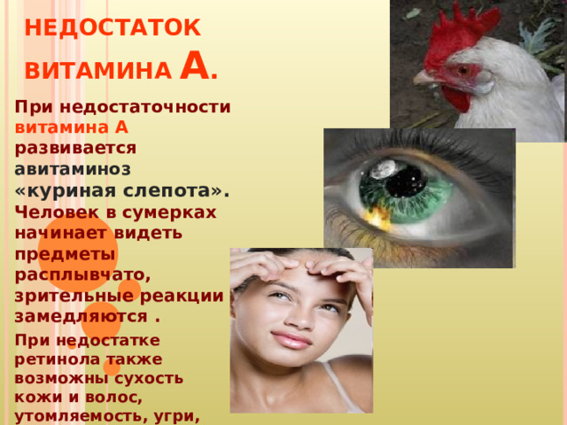 НЕДОСТАТОК ВИТАМИНА А . При недостаточности витамина А развивается авитаминоз  «куриная слепота». Человек в сумерках начинает видеть предметы расплывчато, зрительные реакции замедляются . При недостатке ретинола также возможны сухость кожи и волос, утомляемость, угри, потеря веса, бессонница. 