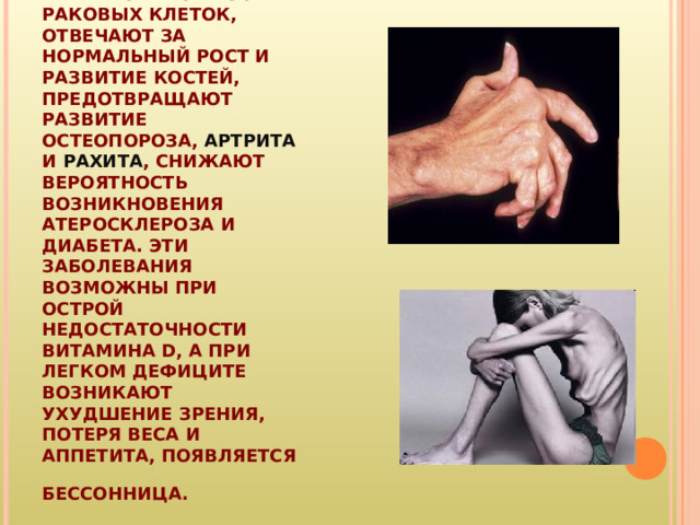 ВИТАМИНЫ ГРУППЫ D ПРЕПЯТСТВУЮТ РОСТУ РАКОВЫХ КЛЕТОК, ОТВЕЧАЮТ ЗА НОРМАЛЬНЫЙ РОСТ И РАЗВИТИЕ КОСТЕЙ, ПРЕДОТВРАЩАЮТ РАЗВИТИЕ ОСТЕОПОРОЗА, АРТРИТА И РАХИТА , СНИЖАЮТ ВЕРОЯТНОСТЬ ВОЗНИКНОВЕНИЯ АТЕРОСКЛЕРОЗА И ДИАБЕТА. ЭТИ ЗАБОЛЕВАНИЯ ВОЗМОЖНЫ ПРИ ОСТРОЙ НЕДОСТАТОЧНОСТИ ВИТАМИНА D, А ПРИ ЛЕГКОМ ДЕФИЦИТЕ ВОЗНИКАЮТ УХУДШЕНИЕ ЗРЕНИЯ, ПОТЕРЯ ВЕСА И АППЕТИТА, ПОЯВЛЯЕТСЯ БЕССОННИЦА.  