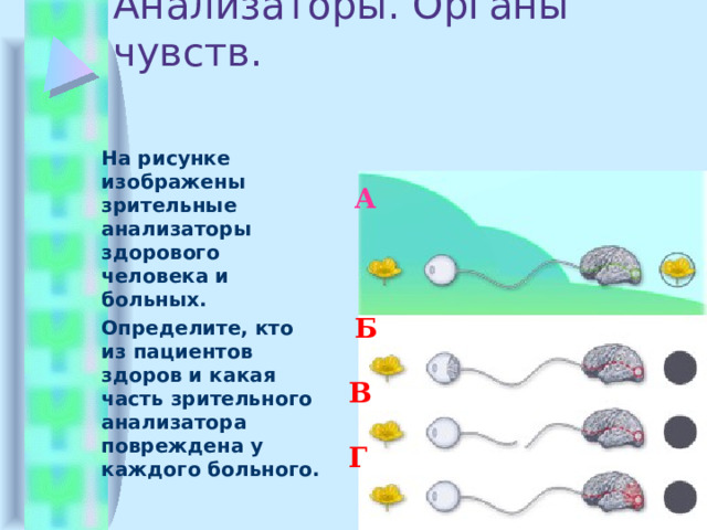 Анализаторы. Органы чувств. На рисунке изображены зрительные анализаторы здорового человека и больных. Определите, кто из пациентов здоров и какая часть зрительного анализатора повреждена у каждого больного.  А Б В Г 
