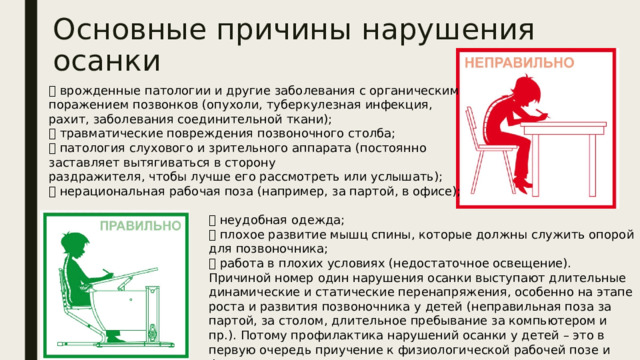 Основные причины нарушения осанки  врожденные патологии и другие заболевания с органическим поражением позвонков (опухоли, туберкулезная инфекция, рахит, заболевания соединительной ткани);   травматические повреждения позвоночного столба;   патология слухового и зрительного аппарата (постоянно заставляет вытягиваться в сторону  раздражителя, чтобы лучше его рассмотреть или услышать);   нерациональная рабочая поза (например, за партой, в офисе);    неудобная одежда;   плохое развитие мышц спины, которые должны служить опорой для позвоночника;   работа в плохих условиях (недостаточное освещение).  Причиной номер один нарушения осанки выступают длительные динамические и статические перенапряжения, особенно на этапе роста и развития позвоночника у детей (неправильная поза за партой, за столом, длительное пребывание за компьютером и пр.). Потому профилактика нарушений осанки у детей – это в первую очередь приучение к физиологической рабочей позе и физические упражнения. 