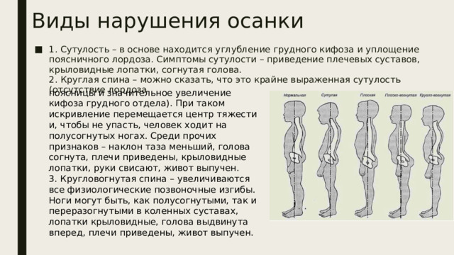 Виды нарушения осанки 1. Сутулость – в основе находится углубление грудного кифоза и уплощение поясничного лордоза. Симптомы сутулости – приведение плечевых суставов, крыловидные лопатки, согнутая голова.  2. Круглая спина – можно сказать, что это крайне выраженная сутулость (отсутствие лордоза поясницы и значительное увеличение кифоза грудного отдела). При таком искривление перемещается центр тяжести и, чтобы не упасть, человек ходит на полусогнутых ногах. Среди прочих признаков – наклон таза меньший, голова согнута, плечи приведены, крыловидные лопатки, руки свисают, живот выпучен.  3. Кругловогнутая спина – увеличиваются все физиологические позвоночные изгибы. Ноги могут быть, как полусогнутыми, так и переразогнутыми в коленных суставах, лопатки крыловидные, голова выдвинута вперед, плечи приведены, живот выпучен.   