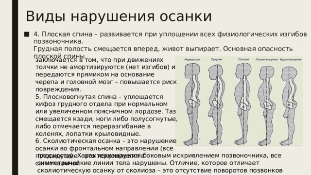 Виды нарушения осанки 4. Плоская спина – развивается при уплощении всех физиологических изгибов позвоночника.  Грудная полость смещается вперед, живот выпирает. Основная опасность плоской спины заключается в том, что при движениях толчки не амортизируются (нет изгибов) и передаются прямиком на основание черепа и головной мозг – повышается риск повреждения.  5. Плосковогнутая спина – уплощается кифоз грудного отдела при нормальном или увеличенном поясничном лордозе. Таз смещается кзади, ноги либо полусогнутые, либо отмечается переразгибание в коленях, лопатки крыловидные.  6. Сколиотическая осанка – это нарушение осанки во фронтальном направлении (все предыдущие – это искривления в сагиттальной плоскости). Характеризируется боковым искривлением позвоночника, все симметрические линии тела нарушены. Отличие, которое отличает сколиотическую осанку от сколиоза – это отсутствие поворотов позвонков вокруг своей оси. 