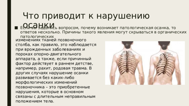 Что приводит к нарушению осанки Если вы задались вопросом, почему возникает патологическая осанка, то ответов несколько. Причины такого явления могут скрываться в органических патологических изменениях тканей позвоночного столба, как правило, это наблюдается при врожденных заболеваниях и пороках опорно-двигательного аппарата, а также, если причинный фактор действует в раннем детстве, например, рахит, родовая травма. В других случаях нарушение осанки развивается без каких-либо морфологических изменений позвоночника – это приобретенные нарушения, которые в основном связаны с длительным неправильным положением тела. 