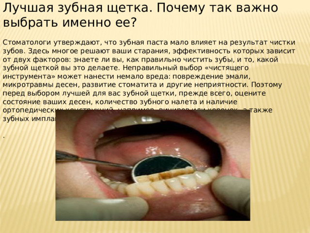 Лучшая зубная щетка. Почему так важно выбрать именно ее? Стоматологи утверждают, что зубная паста мало влияет на результат чистки зубов. Здесь многое решают ваши старания, эффективность которых зависит от двух факторов: знаете ли вы, как правильно чистить зубы, и то, какой зубной щеткой вы это делаете. Неправильный выбор «чистящего инструмента» может нанести немало вреда: повреждение эмали, микротравмы десен, развитие стоматита и другие неприятности. Поэтому перед выбором лучшей для вас зубной щетки, прежде всего, оцените состояние ваших десен, количество зубного налета и наличие ортопедических конструкций, например, виниров или коронок, а также зубных имплантатов. . 