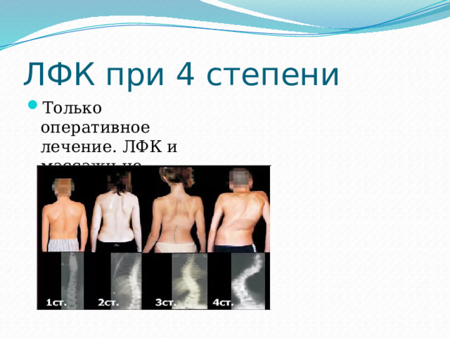 ЛФК при 4 степени Только оперативное лечение. ЛФК и массажи не проводят! 