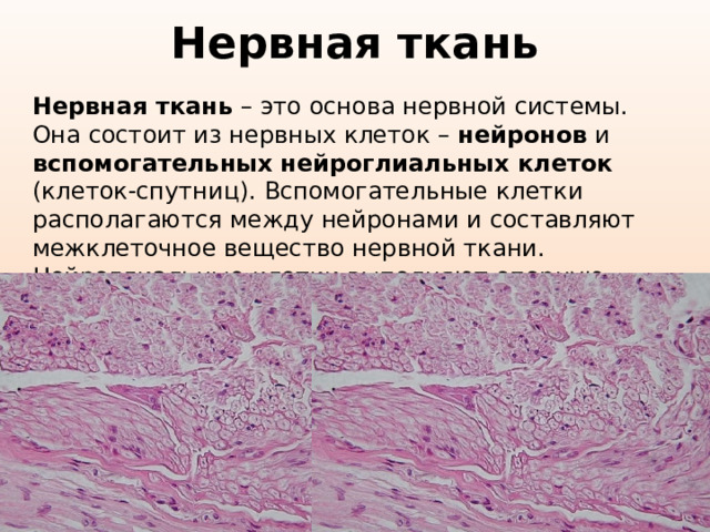 Нервная ткань Нервная ткань – это основа нервной системы. Она состоит из нервных клеток – нейронов и вспомогательных  нейроглиальных клеток (клеток-спутниц). Вспомогательные клетки располагаются между нейронами и составляют межклеточное вещество нервной ткани. Нейроглиальные клетки выполняют опорную, защитную и питательную функции 