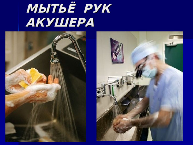 МЫТЬЁ РУК АКУШЕРА 