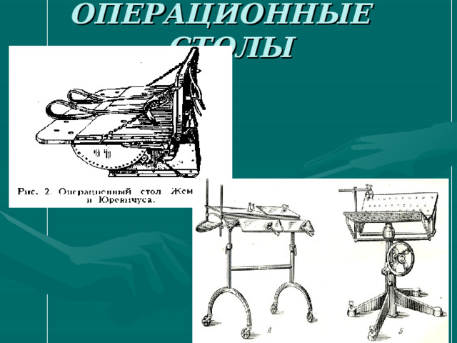 ОПЕРАЦИОННЫЕ СТОЛЫ 