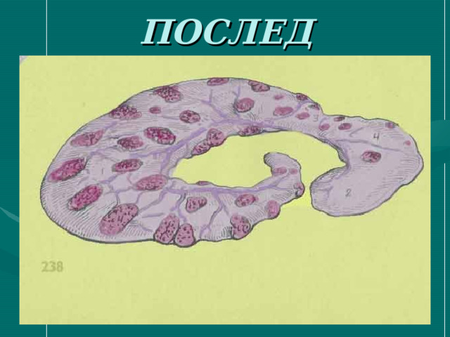 ПОСЛЕД 