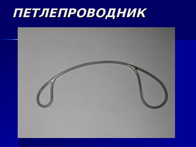 ПЕТЛЕПРОВОДНИК 