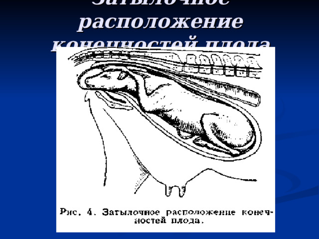 Затылочное расположение конечностей плода 