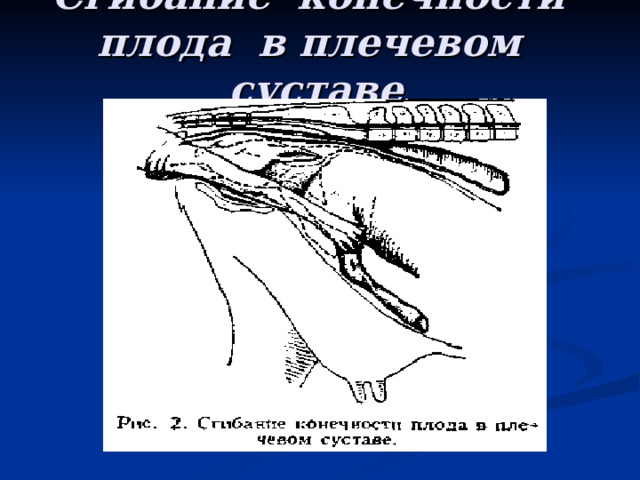 Сгибание конечности плода в плечевом суставе 