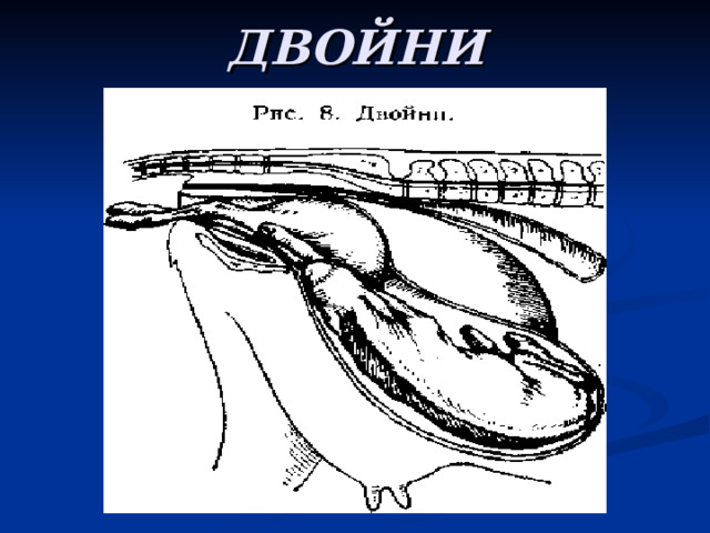 ДВОЙНИ 
