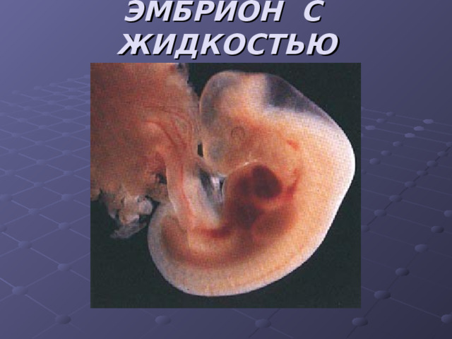 ЭМБРИОН С ЖИДКОСТЬЮ 