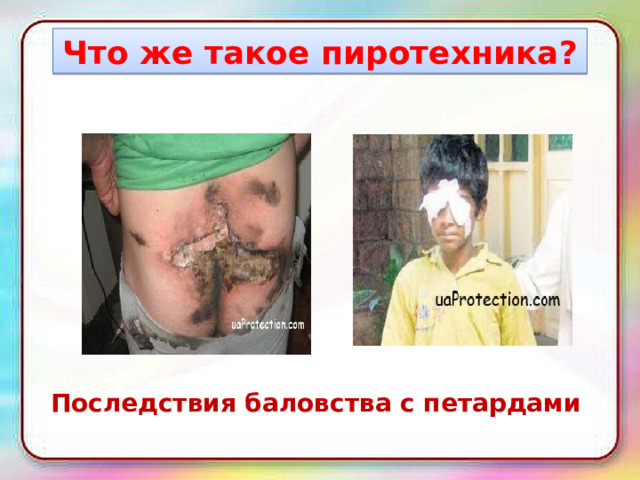 Что же такое пиротехника? Последствия баловства с петардами 
