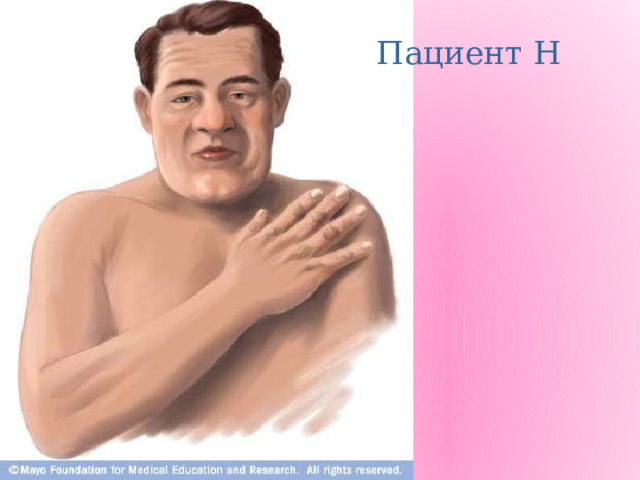 Пациент Н 