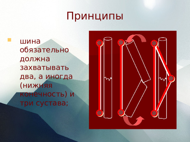 Принципы шина обязательно должна захватывать два, а иногда (нижняя конечность) и три сустава; 