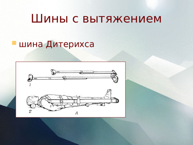 Шины с вытяжением шина Дитерихса 