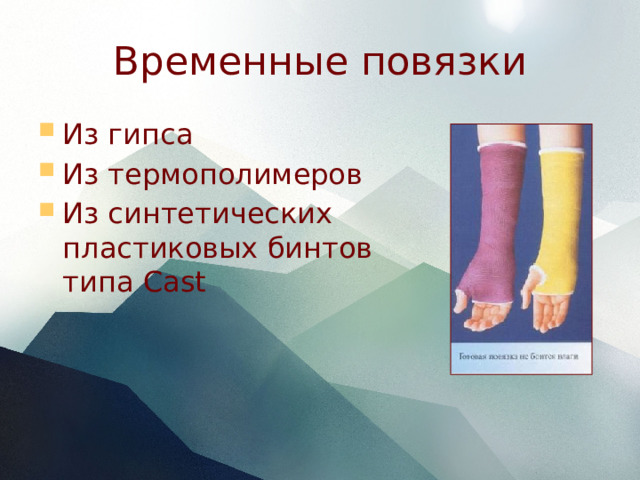 Временные повязки Из гипса Из термополимеров Из синтетических пластиковых бинтов типа Сast 