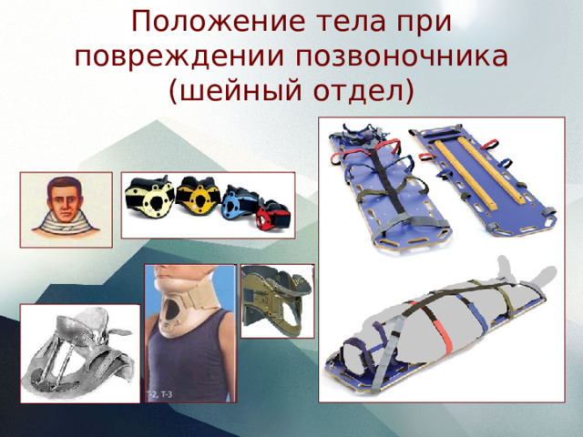 Положение тела при повреждении позвоночника (шейный отдел) 