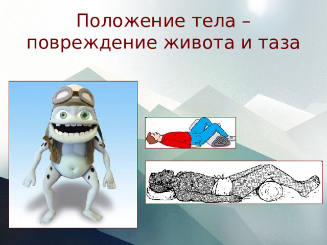 Положение тела – повреждение живота и таза 