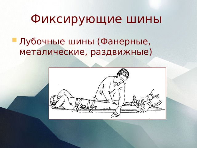 Фиксирующие шины Лубочные шины (Фанерные, металические, раздвижные) 