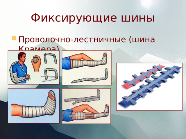 Фиксирующие шины Проволочно-лестничные (шина Крамера) 