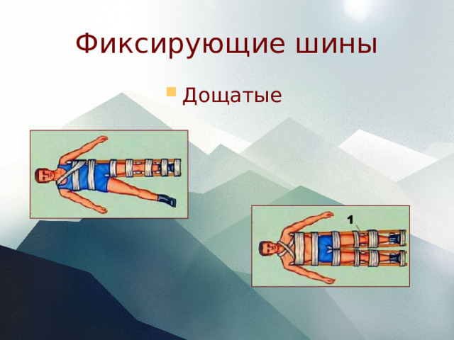 Фиксирующие шины Дощатые 