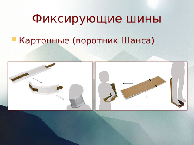 Фиксирующие шины Картонные (воротник Шанса) 