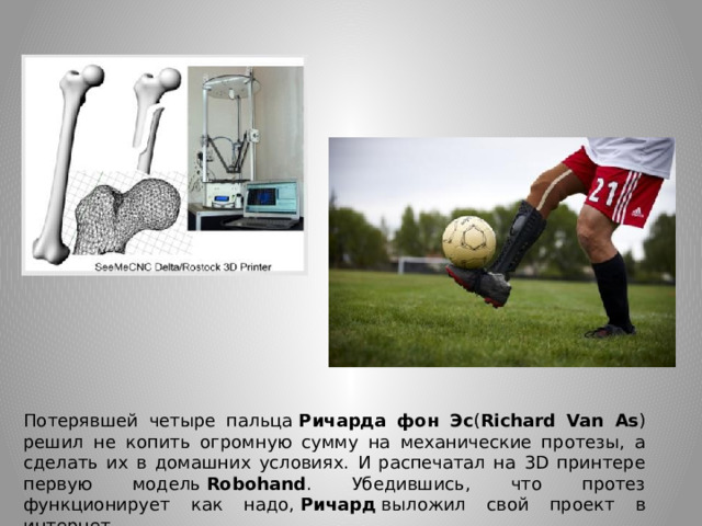 Потерявшей четыре пальца  Ричарда фон Эс ( Richard Van As ) решил не копить огромную сумму на механические протезы, а сделать их в домашних условиях. И распечатал на 3D принтере первую модель  Robohand . Убедившись, что протез функционирует как надо,  Ричард  выложил свой проект в интернет. 