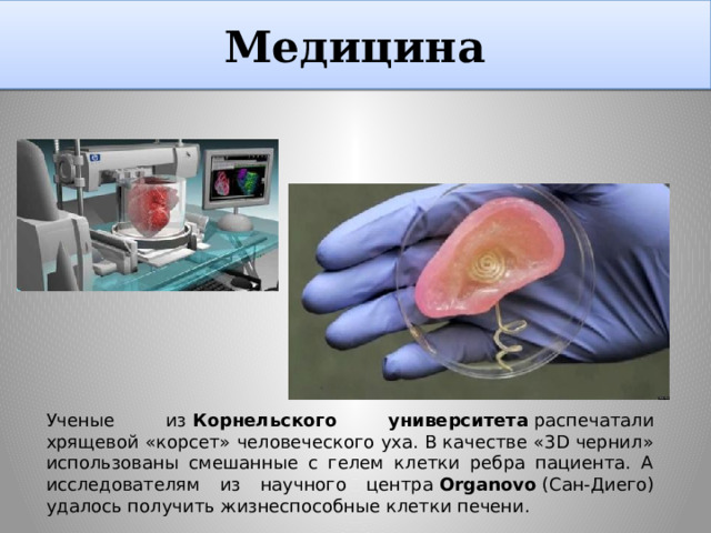 Медицина Ученые из  Корнельского университета  распечатали хрящевой «корсет» человеческого уха. В качестве «3D чернил» использованы смешанные с гелем клетки ребра пациента. А исследователям из научного центра  Organovo  (Сан-Диего) удалось получить жизнеспособные клетки печени.  