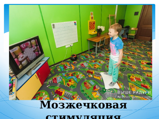 Мозжечковая стимуляция 